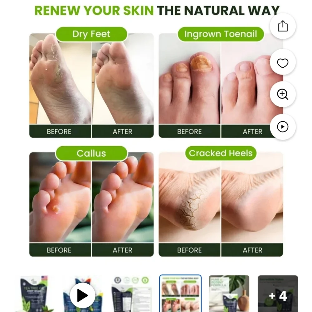 Foot Soak Epsom Salt Pedicure Salts Tea Tree Rosemary First Aid Feet Gift Bag